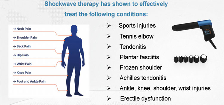 physio magneto shockwave