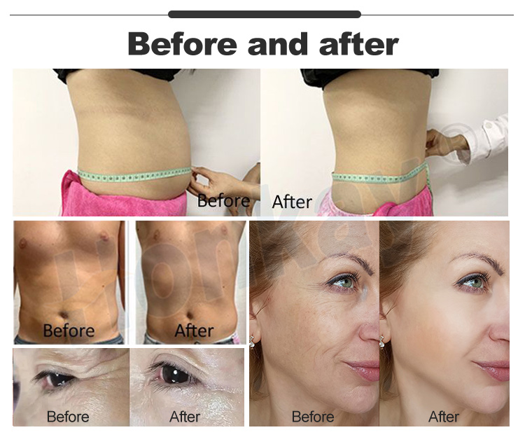 pemf therapy machine for sale