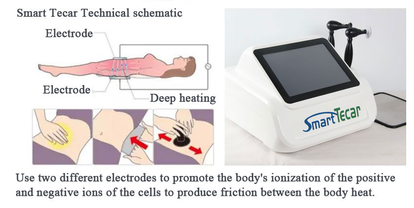 Tecar therapy machines price