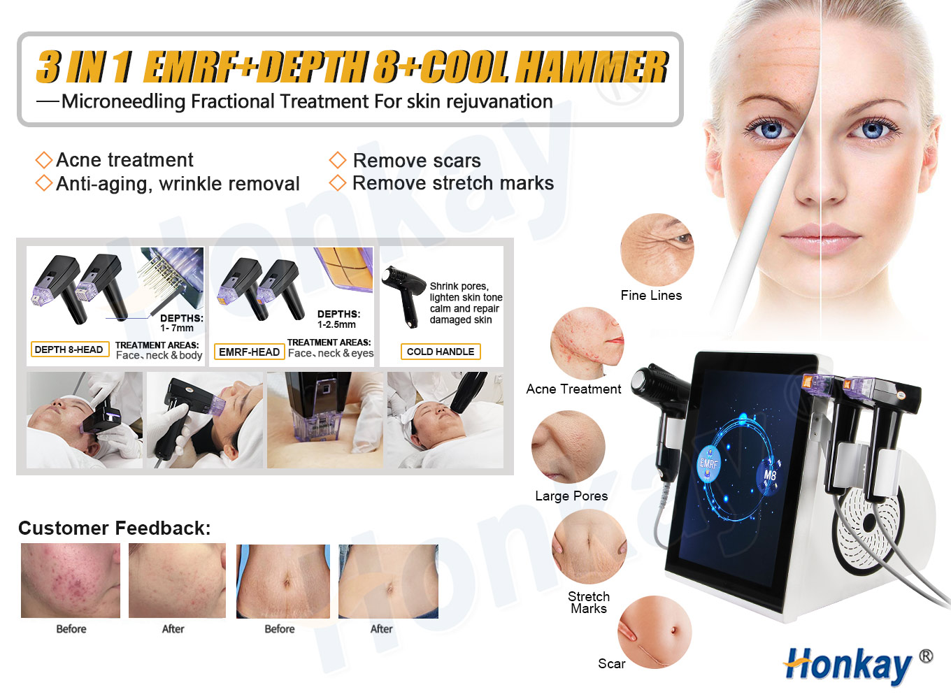 fractional-rf-benefits-20260423