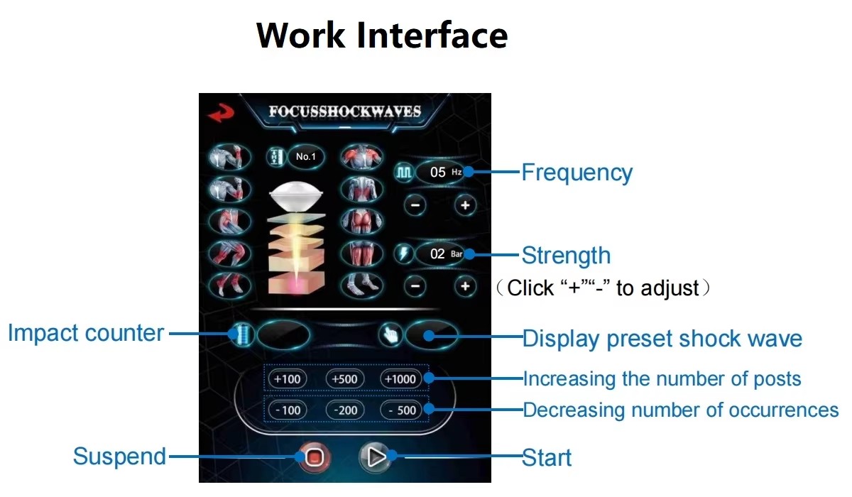 focus shockwave therapy