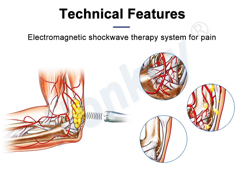 Shock Wave Magnetic Electronic Therapy equipment