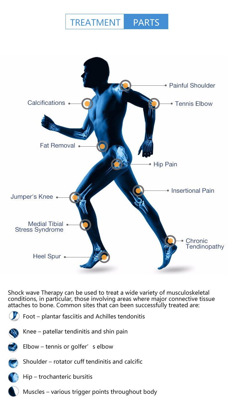 electromagnetic shockwave therapy