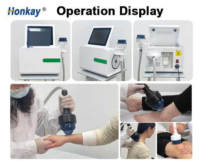 Electromagnetic-focused-shockwave-device-0408