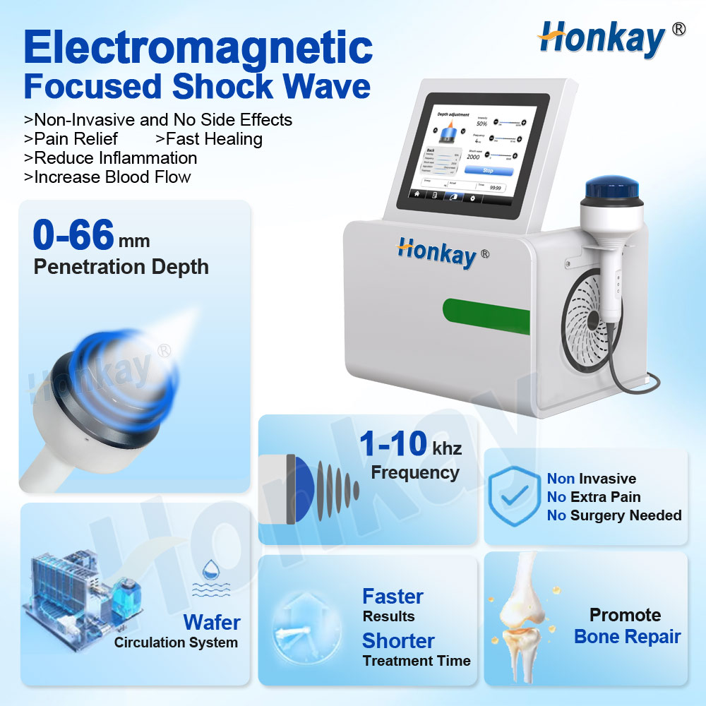 Honkay Shockwave Treatment