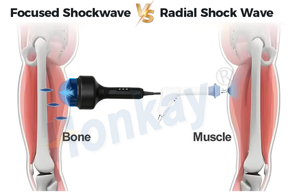 66mm depth focused shockwave device