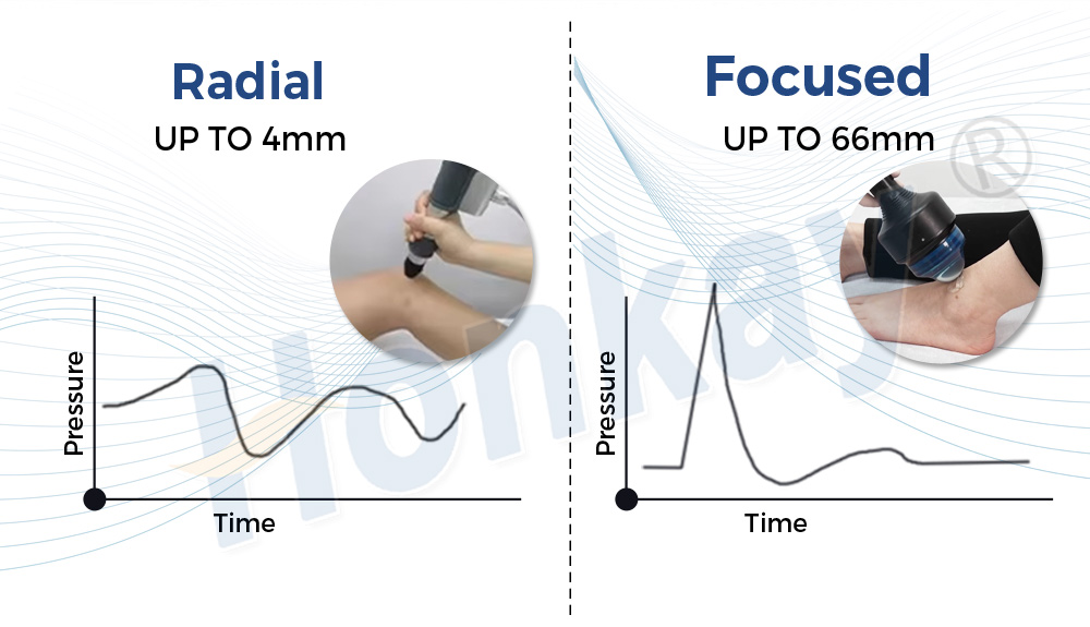 66mm depth focused shockwave equipment