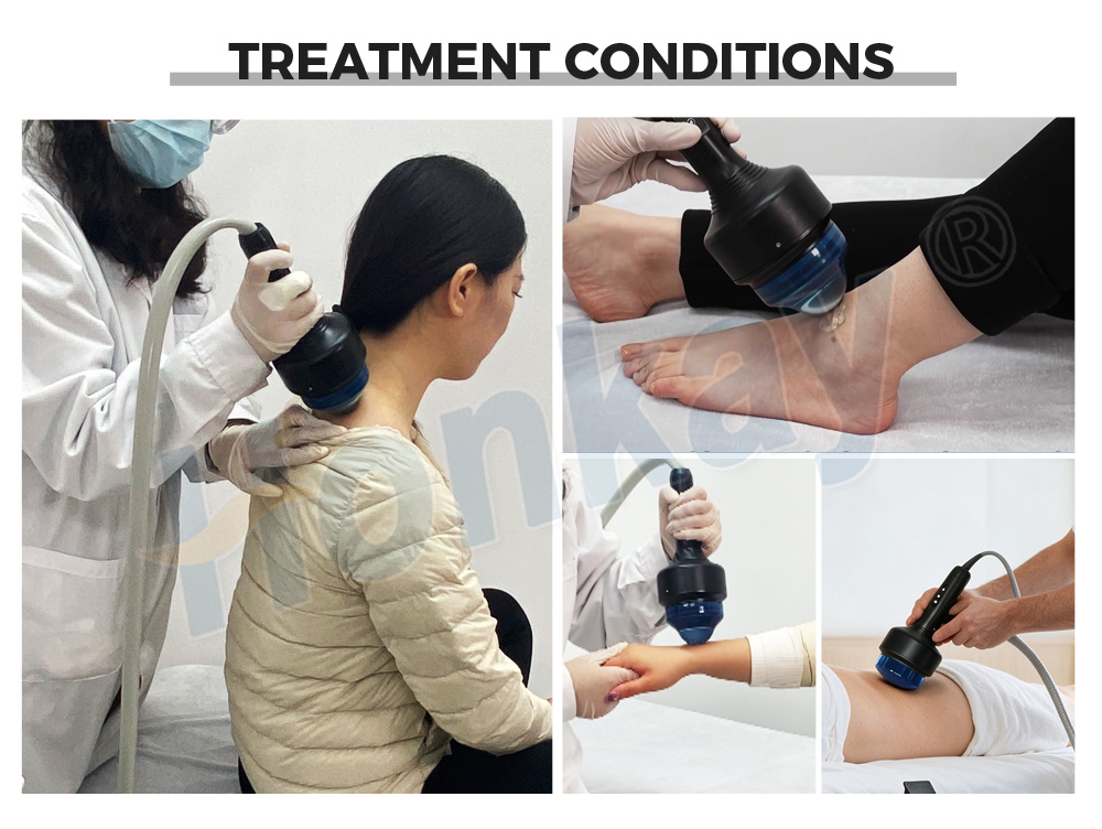 Trolley‑Case Focused Shockwave Therapy Machine