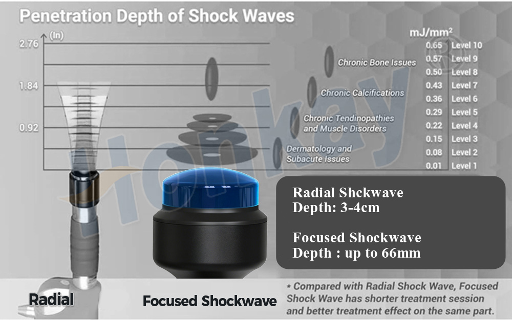 focused shockwave machine For Rehabilitation