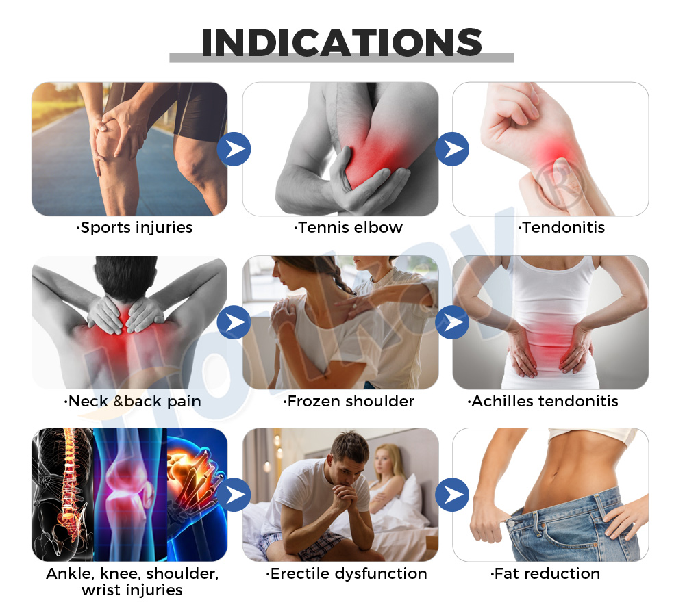 vertical shockwave machine for wellness clinic