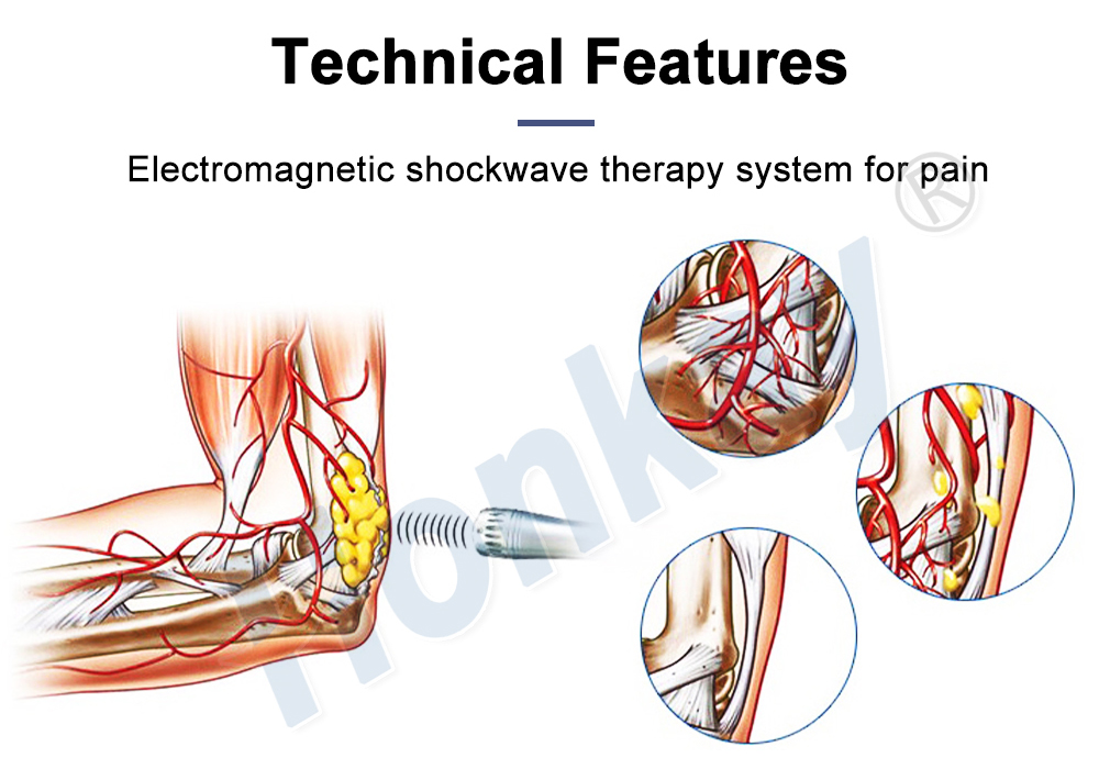 Shockwave Therapy Equipment