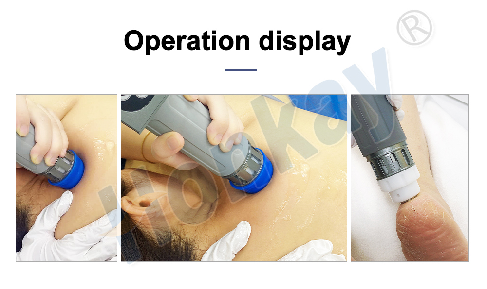 rehabilitation shock wave equipment