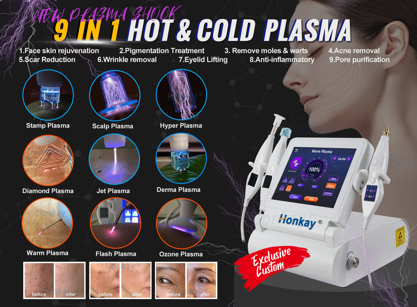 hot-and-cold-plasma-machine-20260416