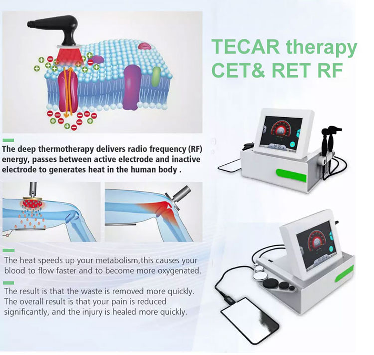 448khz tecar therapy